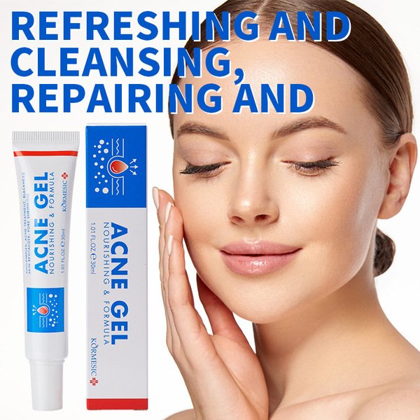 Acne Gel 30g – Anti Acne Treatment Cream - Image 2